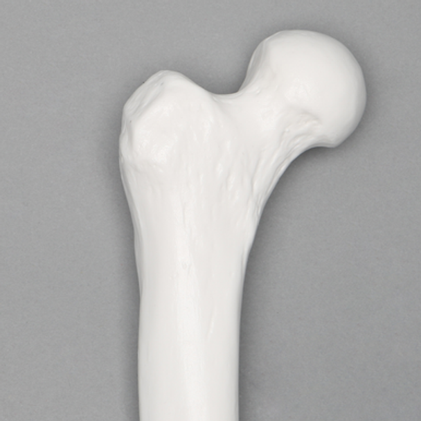 Femur with 15 mm Canal, Plastic Cortical Shell, Right