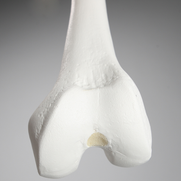 Femur with 12.5 mm Canal, Plastic Cortical Shell, Left