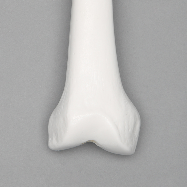 Femur with 12.5 mm Canal, Plastic Cortical Shell, Left