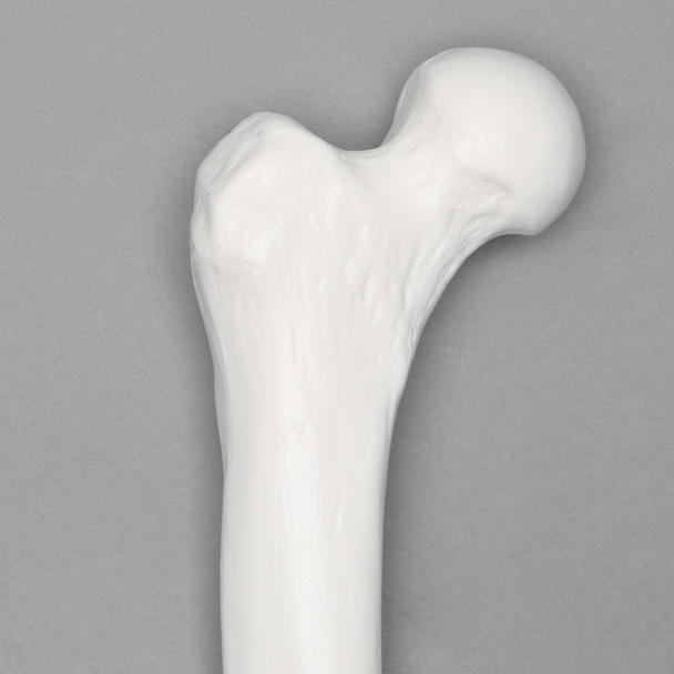 Femur with 12.5 mm Canal, Plastic Cortical Shell, Left