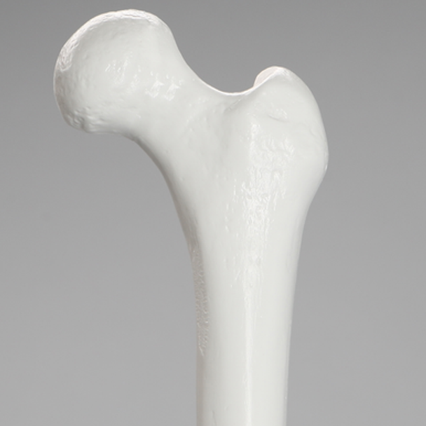 Femur with 15.5 mm Canal, Plastic Cortical Shell, Medium