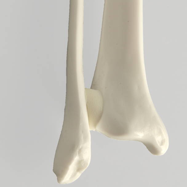 Tibia and Fibula, Plastic Cortical Shell, Medium