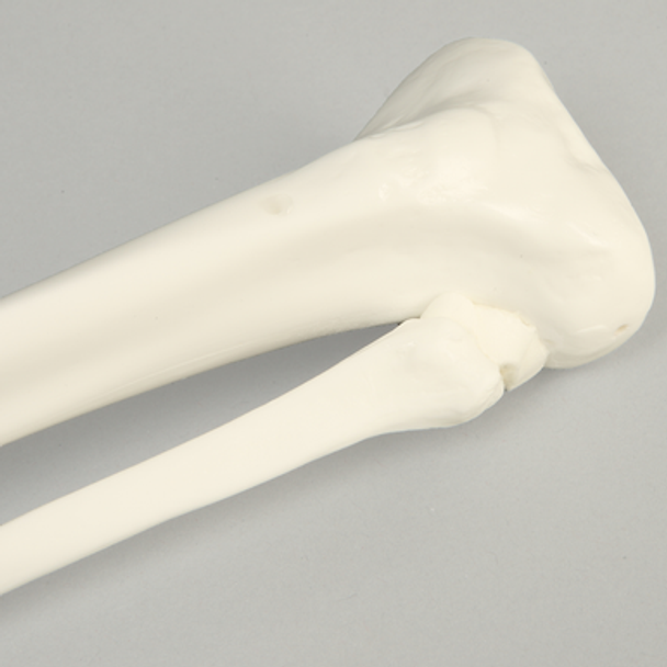 Tibia and Fibula, Plastic Cortical Shell, Medium