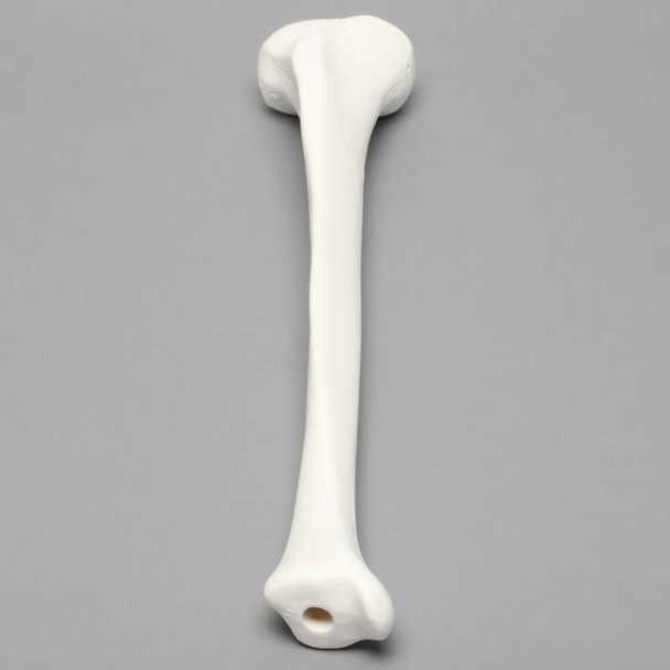 Tibia, Plastic Cortical Shell with 12 mm Canal, Right