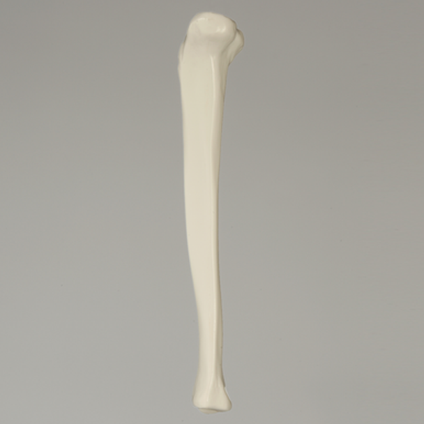 Tibia, Plastic Cortical Shell with 11mm Canal, Left