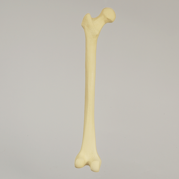 Femur with Narrow Intercondylar Notch, Foam Cortical Shell, Left