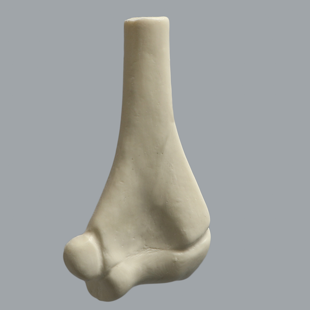 Distal Pediatric Elbow for Wire Navigation Trainer