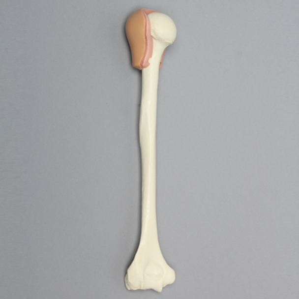 Humerus with Skin Patch, Pediatric Humerus with Skin Patch, Pediatric