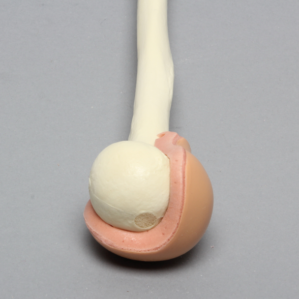 Humerus with Skin Patch, Pediatric