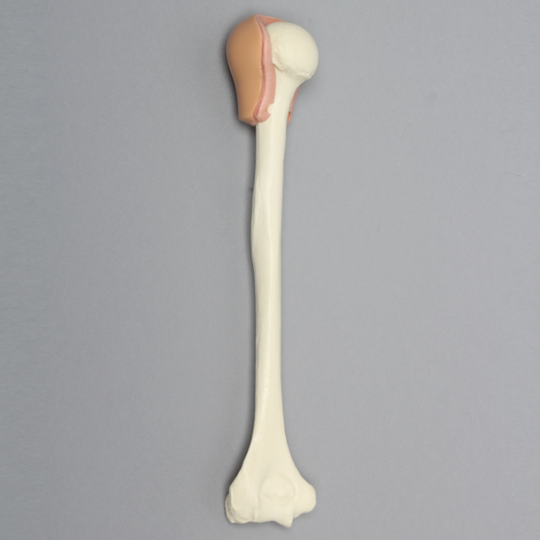 Humerus with Skin Patch, Pediatric