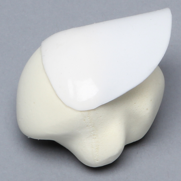 Humeral Head Replacement with Partial Cuff