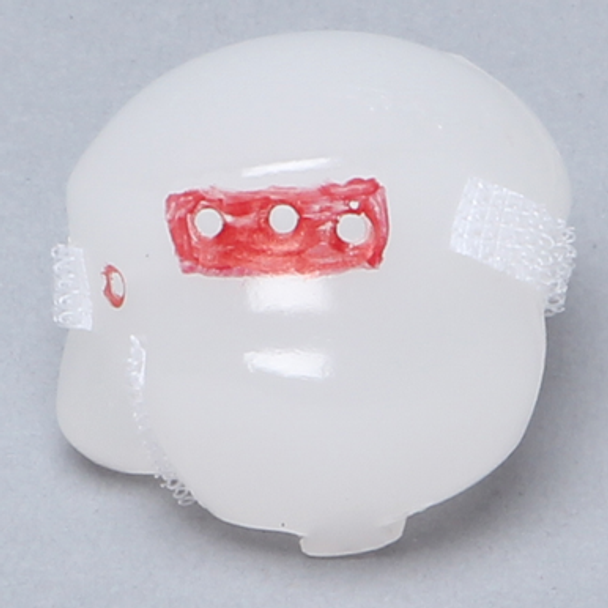 Humeral Head Replacement with Anchor Holes