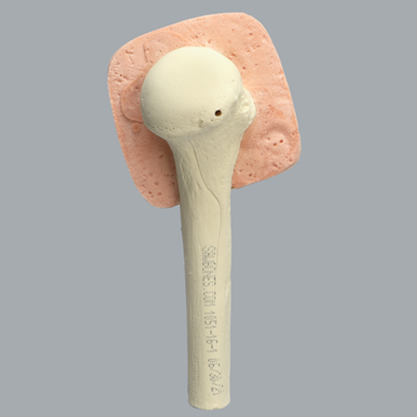Humerus with Skin Patch, Proximal