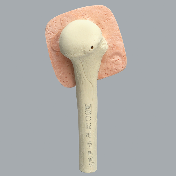 Humerus with Skin Patch, Proximal