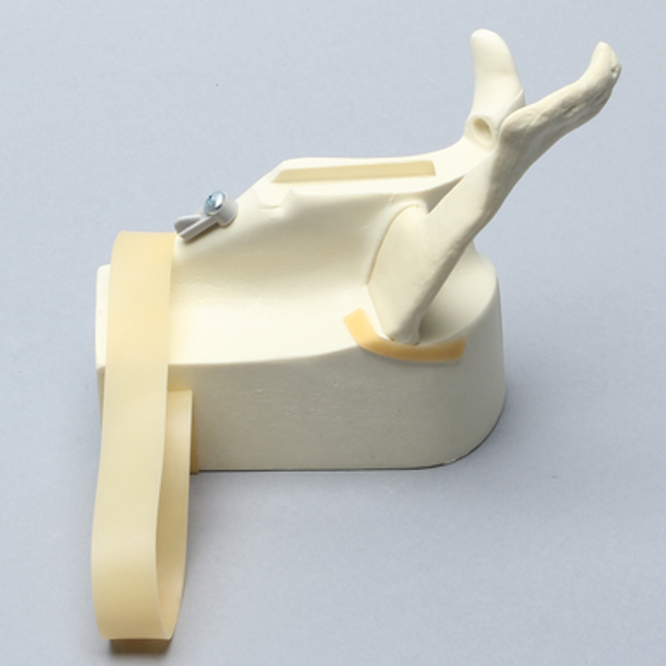 Scapula and Acromion Component for 1509 Shoulder Series