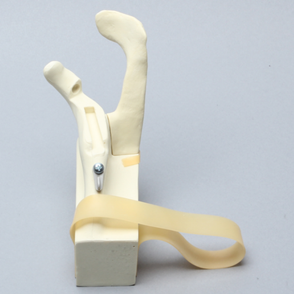 Scapula and Acromion Component for 1509 Shoulder Series