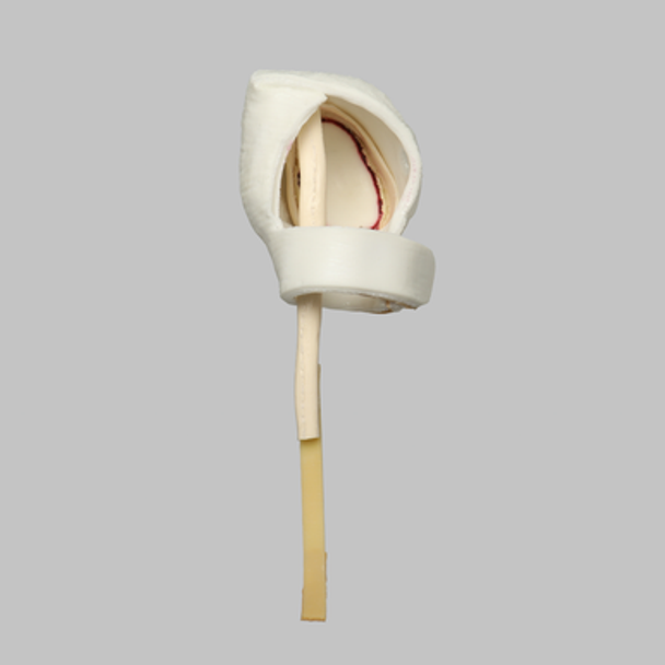 Glenoid Capules Assembly for 1509 Shoulder Series