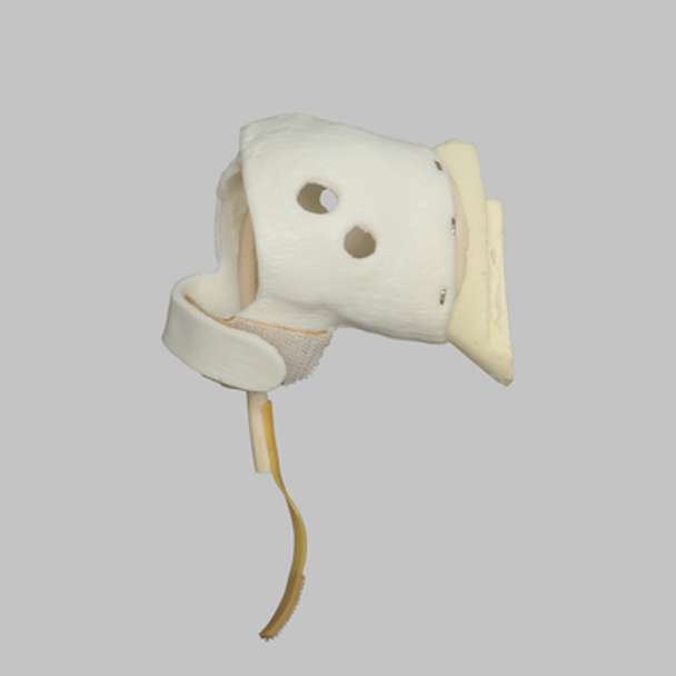 Glenoid Capules Assembly for 1509 Shoulder Series