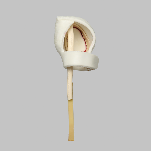 Glenoid Capsule Assembly for 1509 Shoulder Series