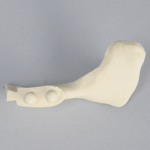 Acromion for ALEX Shoulder Professors
