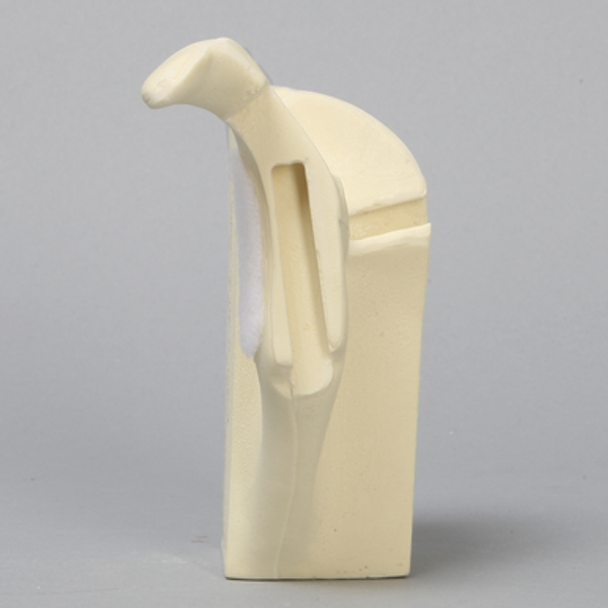 Scapula without Glenoid for Alex Shoulder