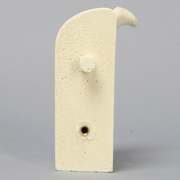 Scapula without Glenoid for Alex Shoulder