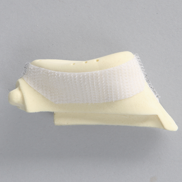 Glenoid with Anchor Tunnels for ALEX II and ALEX III Shoulder Professors