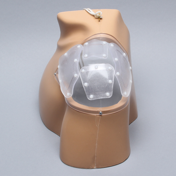 Alex II Shoulder Replacement Shell Alex II Shoulder Replacement Shell