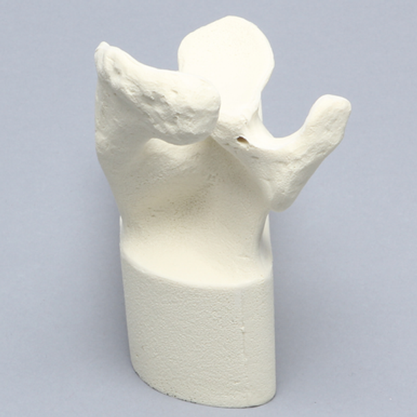 Scapula with Vise Attachment, Foam Cortical, Left