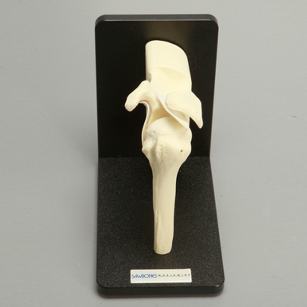 Shoulder with Stand, Foam Cortical, Left