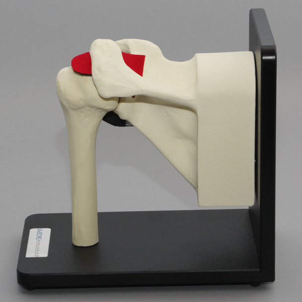 Shoulder Assembly on Stand with Replaceable Parts, Foam Cortical