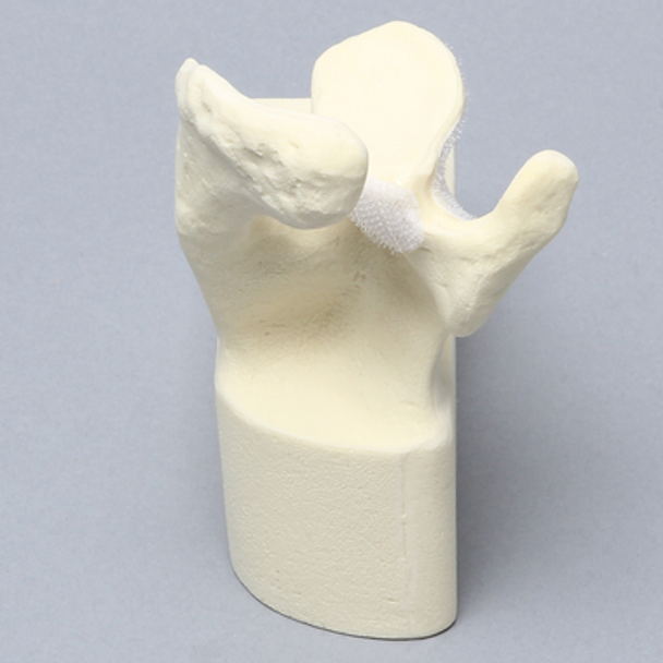 Scapula Replacement for 1050-13, Foam Cortical, Left
