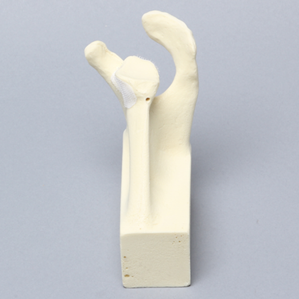 Scapula Replacement for 1050-13, Foam Cortical, Left