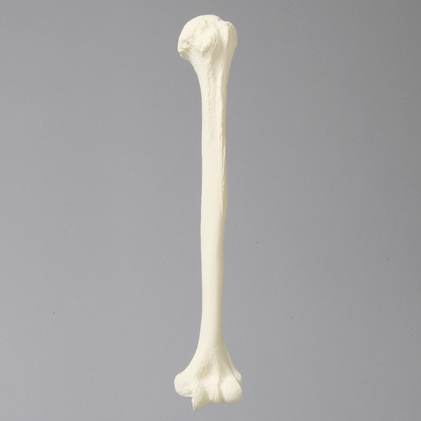 Humerus with 11mm Canal, Foam Cortical