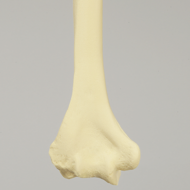 Humerus with Modified Cancellous Density, Foam Cortical