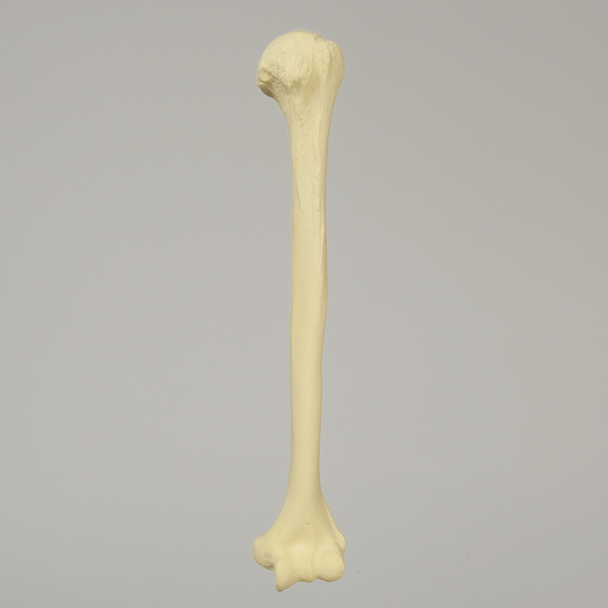 Humerus with Modified Cancellous Density, Foam Cortical