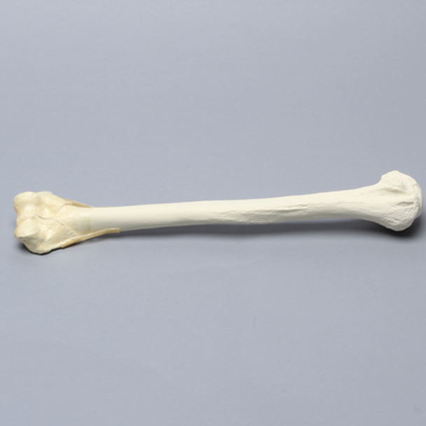 Humerus with "Y" Fracture and Periosteum, Foam Cortical