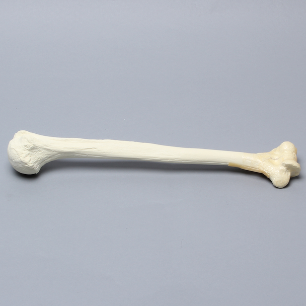 Humerus with "Y" Fracture and Periosteum, Foam Cortical