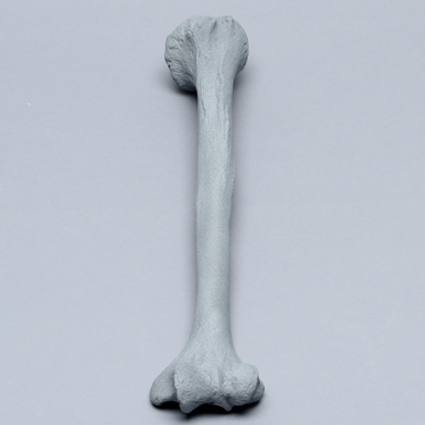 Humerus with Radiopaque Properties
