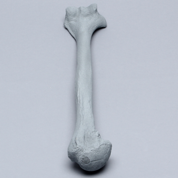 Humerus with Radiopaque Properties