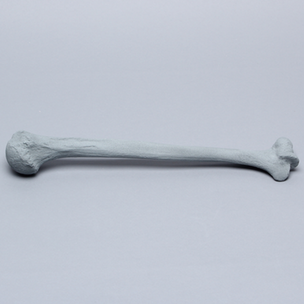 Humerus with Radiopaque Properties