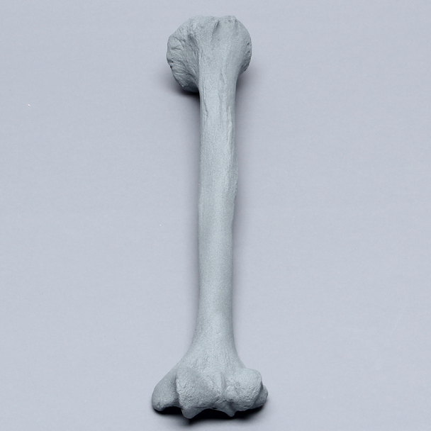 Humerus with Radiopaque Properties