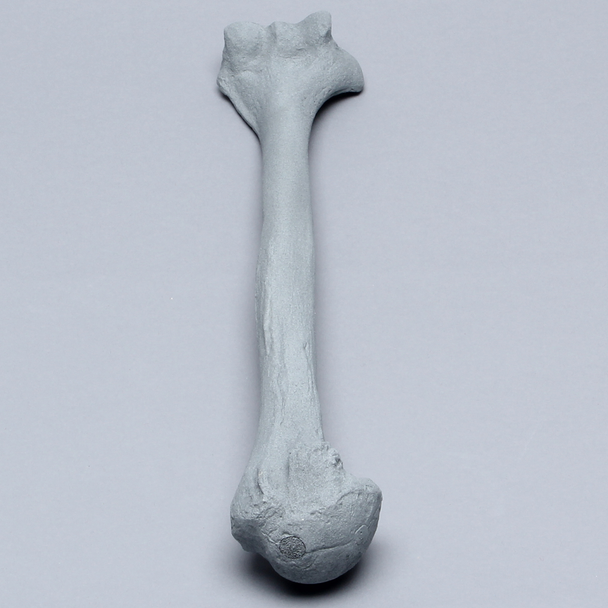 Humerus with Radiopaque Properties