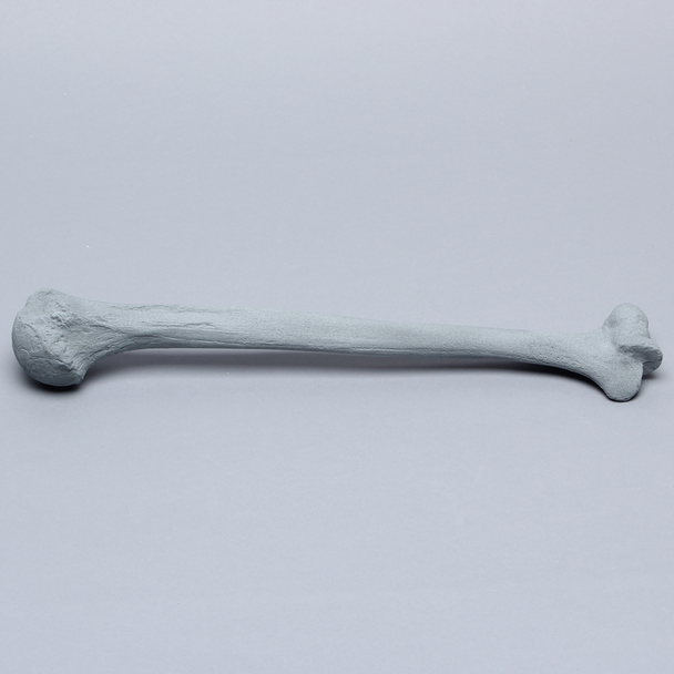 Humerus with Radiopaque Properties
