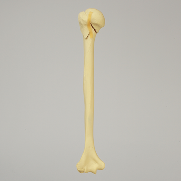 Humerus with Three-Part Head Fracture, Foam Cortical