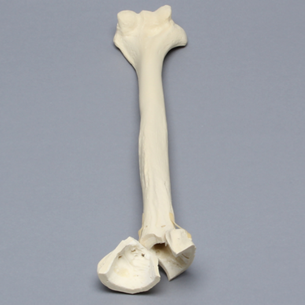 Humerus with Fractures and Suture Holes, Foam Cortical