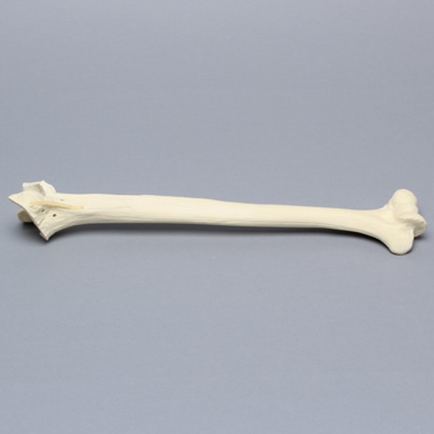 Humerus with Fractures and Suture Holes, Foam Cortical