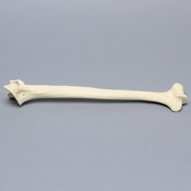 Humerus with Fractures and Suture Holes, Foam Cortical