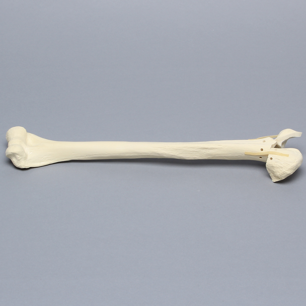 Humerus with Fractures and Suture Holes, Foam Cortical