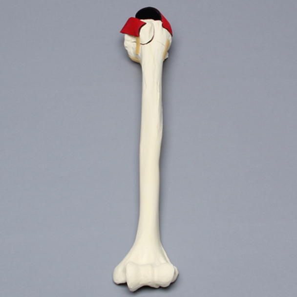 Humerus with Five-Part Head Fracture and Ligaments, Foam Cortical